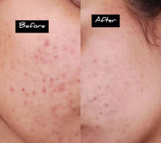 Minimalist 2% Salicylic Acid Face Wash